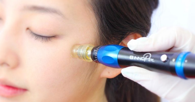 6 xu hướng dẫn đầu năm 2018 mà các tín đồ làm đẹp không thể bỏ lỡ ảnh 15