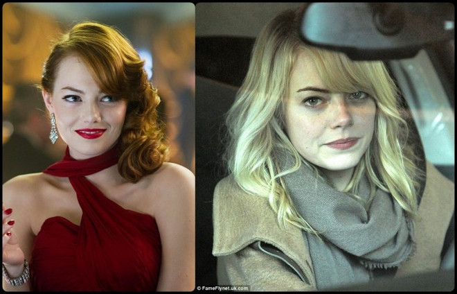 Không chỉ riêng bạn, các ngôi sao cũng từng khổ sở vì làn da ảnh 8