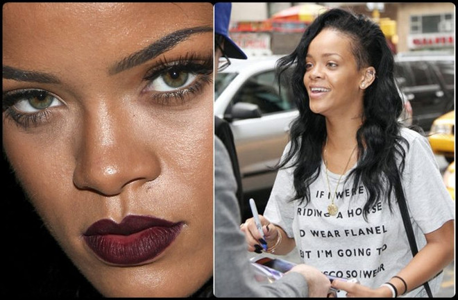 Không chỉ riêng bạn, các ngôi sao cũng từng khổ sở vì làn da ảnh 1