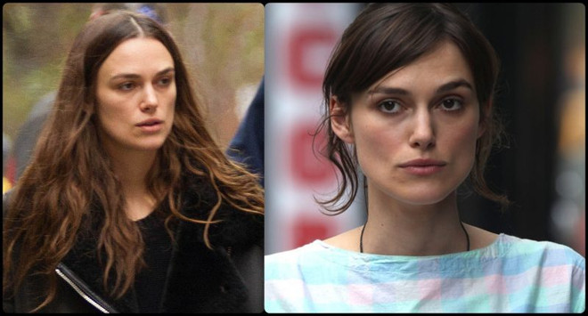 Không chỉ riêng bạn, các ngôi sao cũng từng khổ sở vì làn da ảnh 3