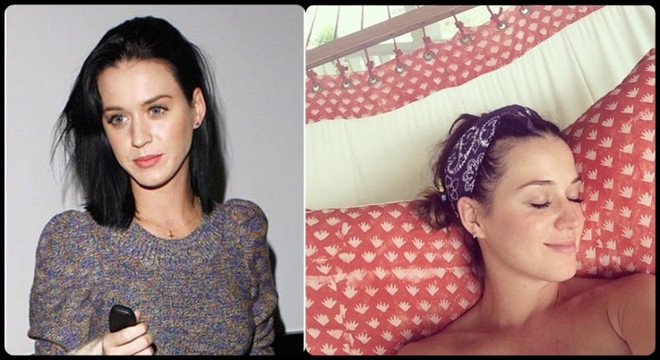 Không chỉ riêng bạn, các ngôi sao cũng từng khổ sở vì làn da ảnh 6