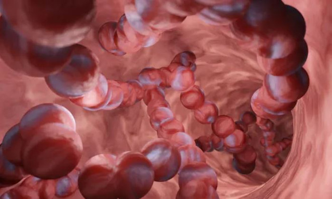 Australia khuyến cáo dân thận trọng khi số ca nhiễm khuẩn xâm lấn tăng ảnh 1