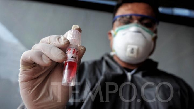 Indonesia bắt đầu sản xuất bộ dụng cụ xét nghiệm nhanh COVID-19 ảnh 1