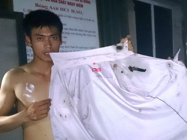 Truy đuổi xe nghi ngờ chở axit gây bỏng cho người đi đường ảnh 2