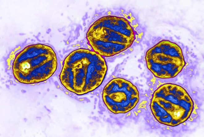 Ca bệnh thứ 3 trên thế giới khỏi HIV/AIDS nhờ cấy ghép tế bào gốc ảnh 1