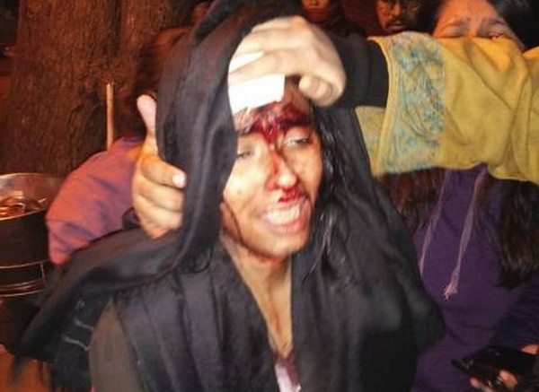 Ấn Độ: Ẩu đả tại Đại học JNU danh tiếng, ít nhất 23 người bị thương ảnh 1