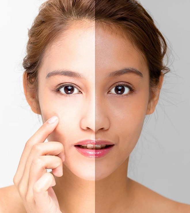 Cuộc chiến nảy lửa giữa da và nắng Hè khi nào kết thúc? ảnh 2