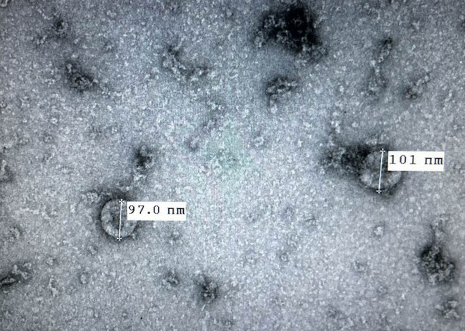 Các nhà khoa học nữ phân lập virus SARS-CoV-2 nhận giải Kovalevskaia ảnh 2