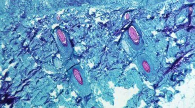 Ecuador ghi nhận trường hợp đầu tiên nghi mắc bệnh đậu mùa khỉ ảnh 1