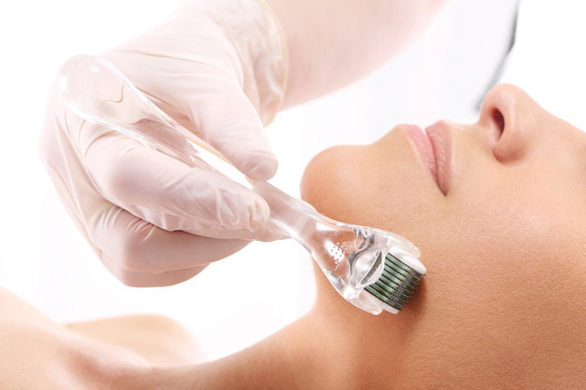 Thận trọng khi lựa chọn phương pháp lăn kim để làm đẹp da ảnh 1
