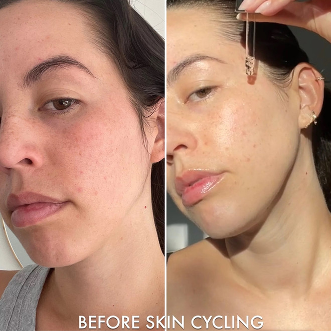 Xu hướng dưỡng da tối giản skin cycling liệu có đáng thử? ảnh 4