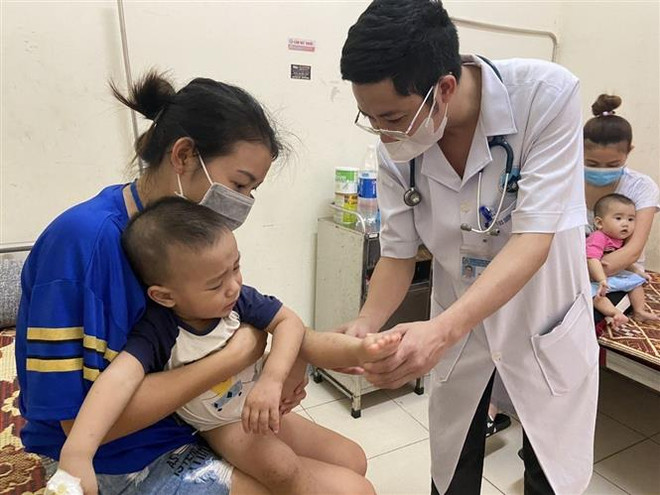 TP.HCM: Có thể xuất hiện nhiều ca bệnh tay chân miệng nặng và tử vong ảnh 2