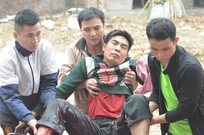 Bắc Ninh: Đầu đạn lại phát nổ, một nam thanh niên bị thương ảnh 1