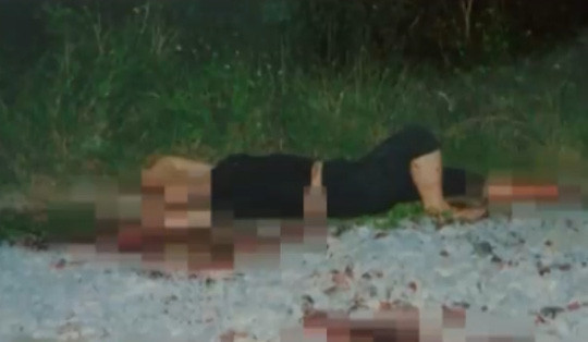 Người tự thuê chặt chân tay từng “gạ” cảnh sát chia tiền bảo hiểm ảnh 1