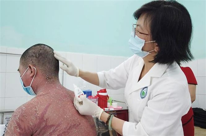 Bị biến chứng nặng do điều trị bệnh vẩy nến bằng thuốc mua trên mạng ảnh 1