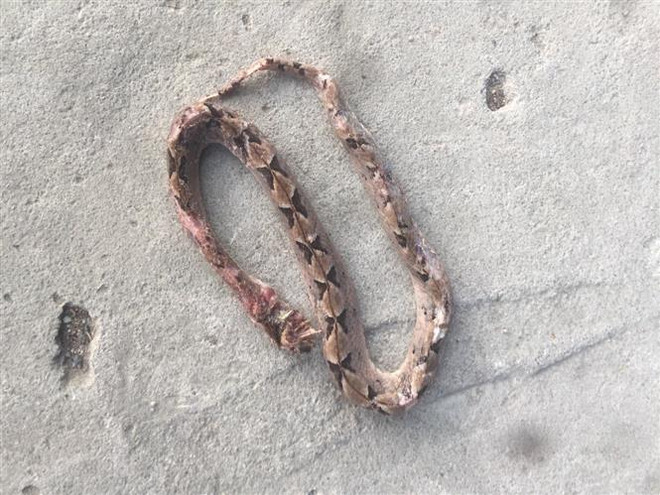 Cứu sống hai bệnh nhân bị biến chứng nguy kịch do rắn độc cắn ảnh 1