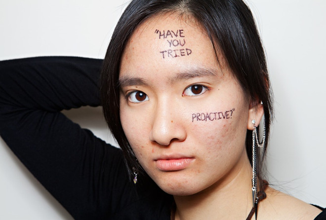 Những câu nói mang tính "sát thương" đỉnh cao với cô nàng da mụn ảnh 1