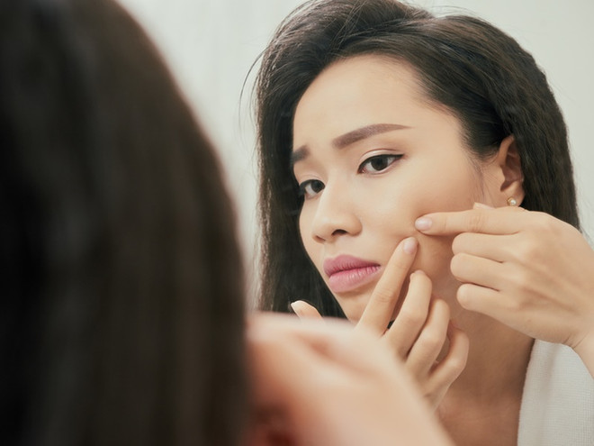 Những câu nói mang tính "sát thương" đỉnh cao với cô nàng da mụn ảnh 4