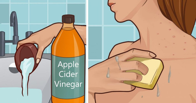 Bảy bí quyết tuyệt hay để chăm sóc da và tóc bằng giấm táo ảnh 2