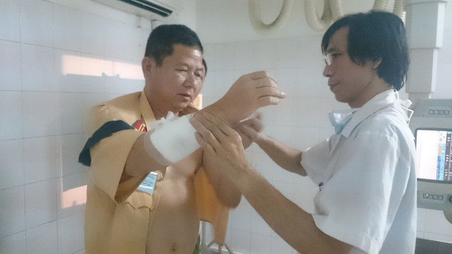 Say rượu, nam thanh niên dùng gạch ném gãy tay cảnh sát ảnh 1