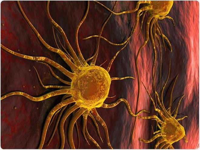 Ung thư là nguyên nhân gây tử vong hàng đầu tại các nước giàu ảnh 1