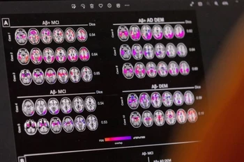 Ảnh minh họa. (Nguồn: Reuters)