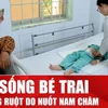 Bệnh viện Nhi đồng Đồng Nai cứu thành công ca thủng ruột do nuốt nam châm