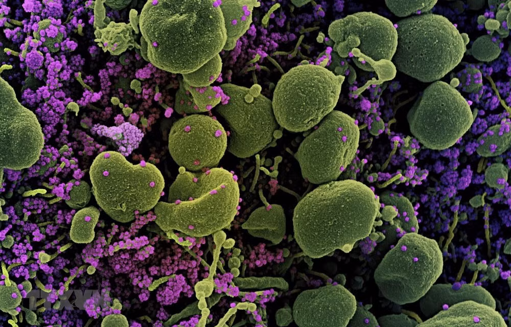 Anh: Đại học Oxford thử nghiệm tái nhiễm virus SARS-CoV-2 ảnh 1