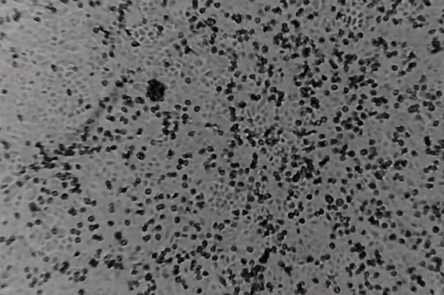 Các nhà khoa học Thụy Sỹ phát hiện sức mạnh chống virus của đường ảnh 1