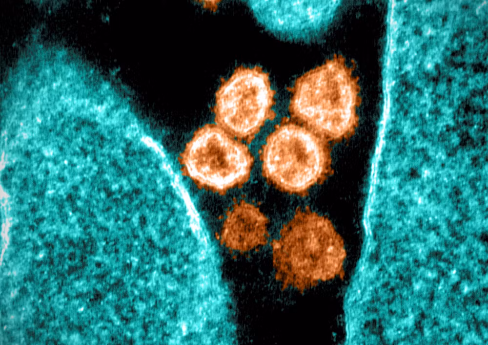 Thiết bị lọc không khí có thể loại bỏ virus SARS-CoV-2 lơ lửng ảnh 1