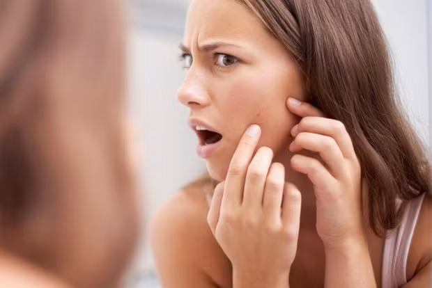 Bí quyết chọn sản phẩm chống nắng cho làn da mụn đỏng đảnh ảnh 1