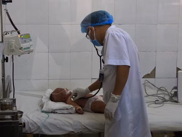Một cháu nhỏ tử vong nghi do viêm màng não mô cầu tại Đắk Lắk ảnh 1