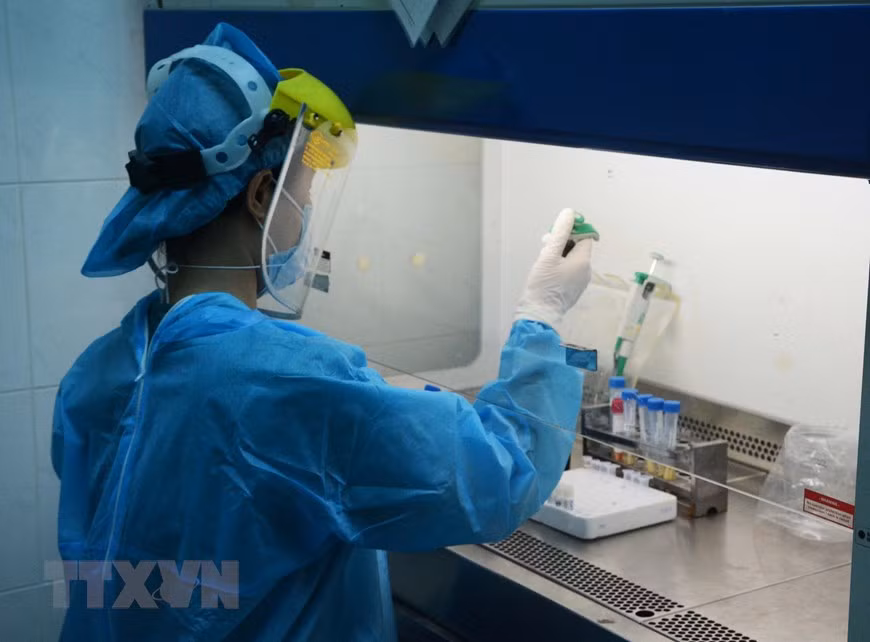 Quảng Bình chính thức vận hành hệ thống xét nghiệm virus SARS-CoV-2 ảnh 1