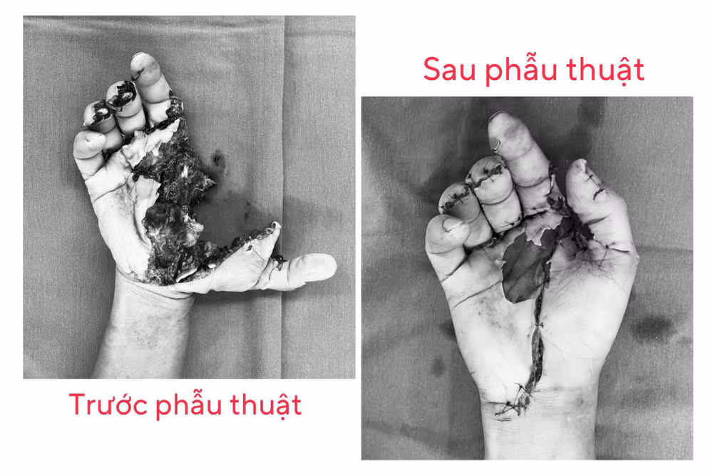 ảnh so 2.jpeg