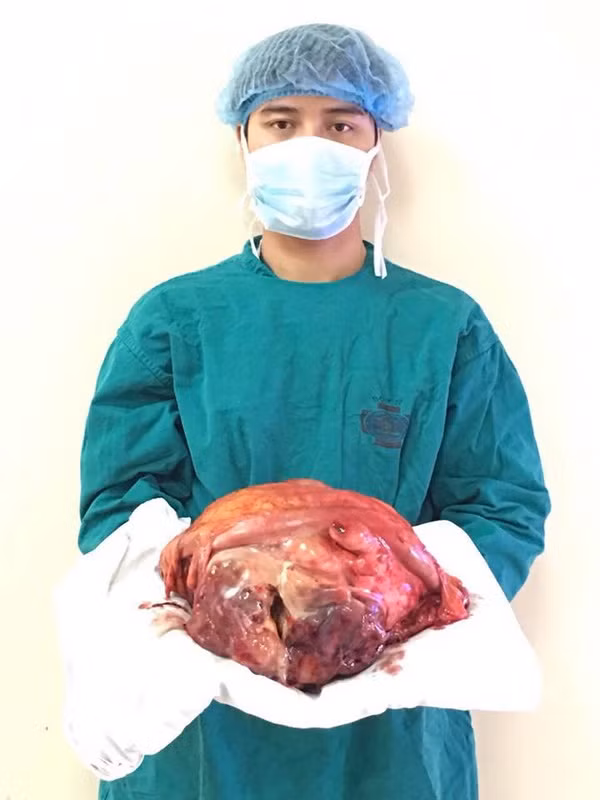Phẫu thuật lấy khối u đường kính gần 0,5m trong bụng ông lão ảnh 2