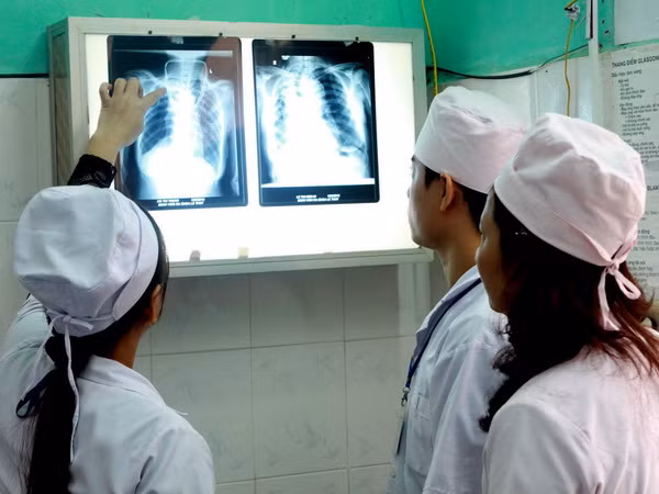 10% người Việt bị phổi tắc nghẽn mạn tính, hen phế quản ảnh 1