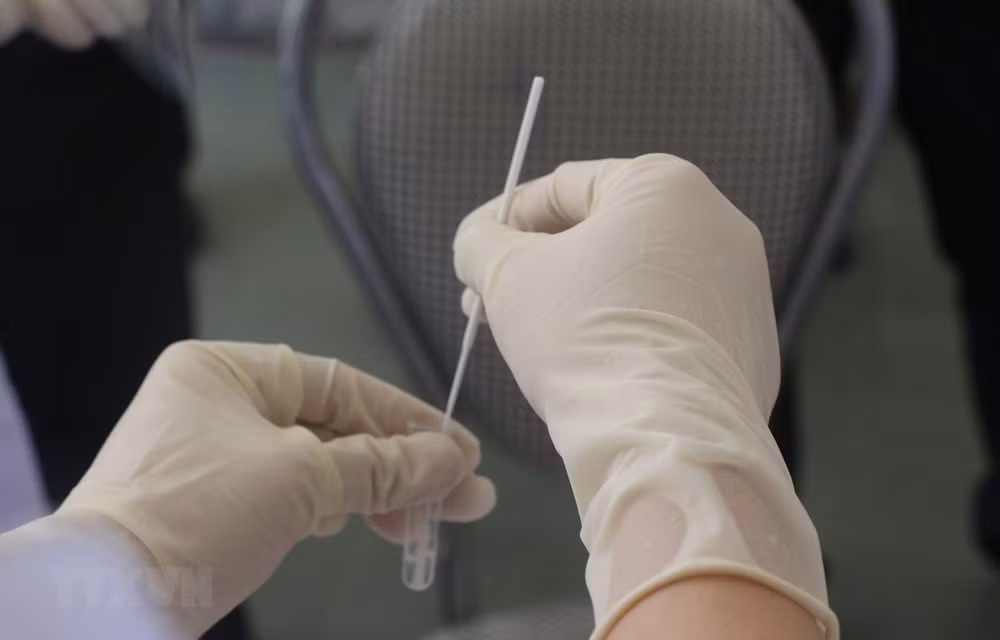 Thanh Hóa: Kiểm điểm sai sót về test COVID-19 sau phản ánh của TTXVN ảnh 1
