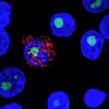 Nghiên cứu mới cho thấy thuốc lenacapavir có thể ức chế virus HIV trong cả năm. (Nguồn: Science.org)