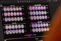 Ảnh minh họa. (Nguồn: Reuters)