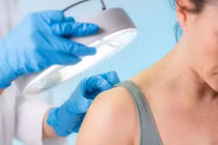 Khi cơ thể bật chế độ cảnh báo, da sẽ phản ứng dữ dội thường đúng lúc bạn không hề mong muốn. (Nguồn: Getty Images)