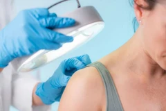 Khi cơ thể bật chế độ cảnh báo, da sẽ phản ứng dữ dội thường đúng lúc bạn không hề mong muốn. (Nguồn: Getty Images)