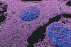 Ảnh huỳnh quang miễn dịch 3D cho thấy các tế bào u hắc tố (màu tím hồng) bị nhiễm vi khuẩn (màu xanh ngọc); nhân tế bào có màu xanh lam. (Nguồn: Viện Khoa học Weizmann)