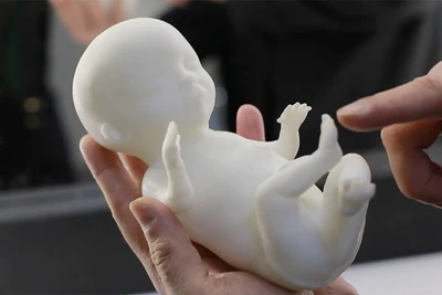 Công nghệ in 3D đem tới mô hình vô cùng chân thực của thai nhi