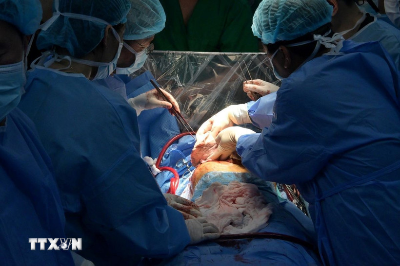 Bác sỹ Bệnh viện Phổi Trung ương đang tiến hành phẫu thuật cho bệnh nhân. (Ảnh: TTXVN phát)