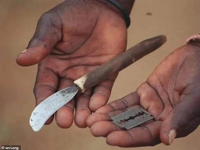 Phần tiểu phẫu trong nghi lễ trưởng thành dẫn đến cái chết của một số người tham gia mỗi năm. (Ảnh: Wvi).