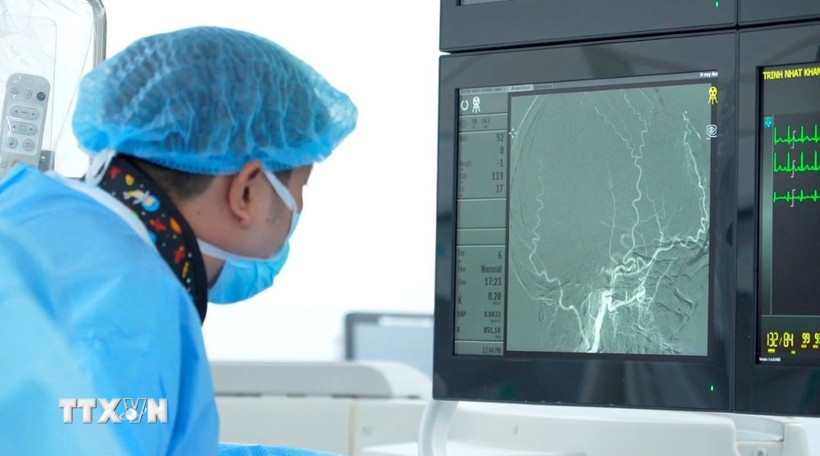 Bác sỹ Bệnh viện FV quan sát hình ảnh các mạch máu não quanh khối u trong quá trình làm tắc mạch. (Ảnh: TTXVN phát)