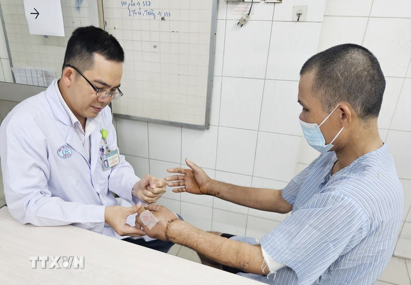 Bác sỹ kiểm tra hai bàn tay được nối thành công của nạn nhân. (Ảnh: TTXVN phát)