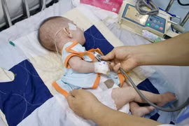 Bác sỹ khám, theo dõi sức khỏe cho một trẻ mắc sởi. (Ảnh: TTXVN/Vietnam+)