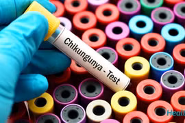 Hiện nay, dịch bệnh Chikungunya đang có xu hướng gia tăng. (Ảnh: PV/Vietnam+)