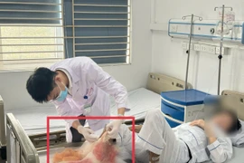 Bệnh nhân nhập viện trong tình trạng cẳng chân hoại tử nặng, bốc mùi hôi thối. (Ảnh: PV/Vietnam+)
